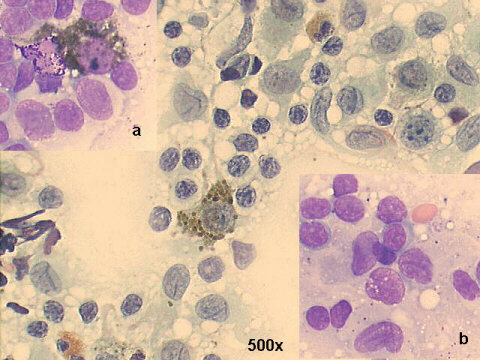 500x M-G-G and Papanicolaou staining
