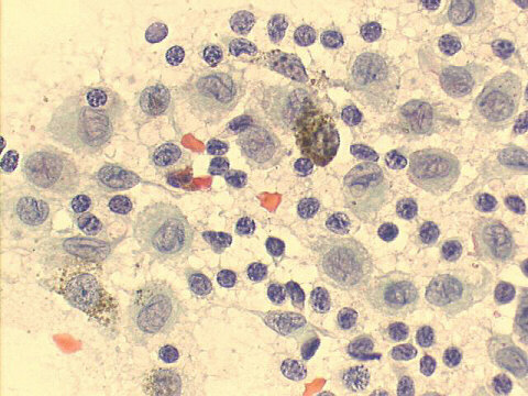500x Papanicolaou staining