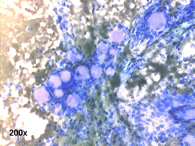 200x M-G-G staining
