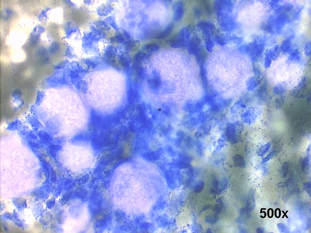 500x M-G-G staining