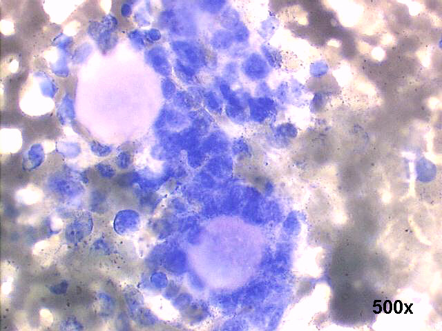 500x M-G-G staining