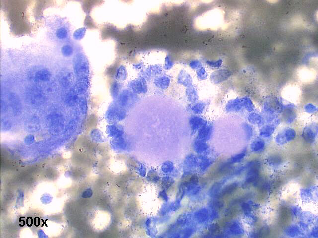 500x M-G-G staining