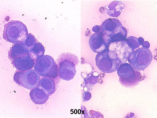 500x M-G-G staining, many anemone cells with microvilli