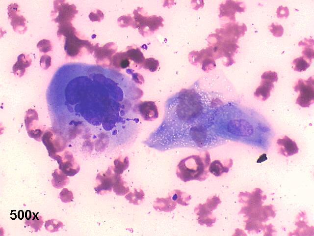 500x oil M-G-G staining