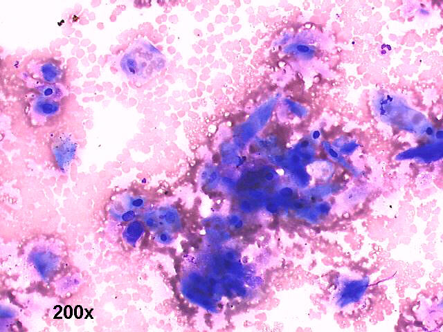 200x M-G-G staining