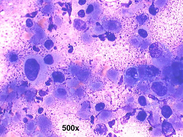 500x M-G-G staining