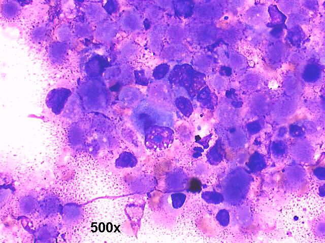 500x M-G-G staining