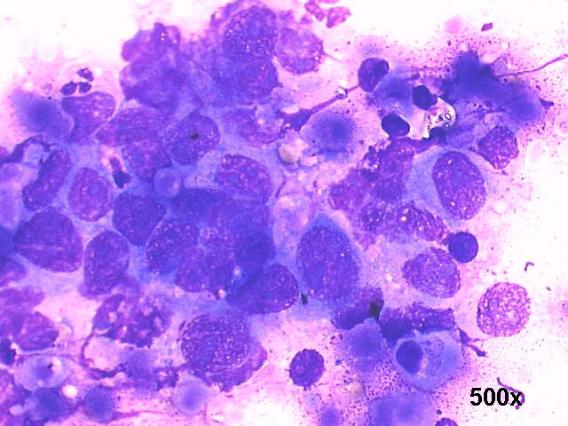 500x M-G-G staining