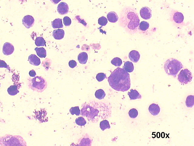 500x M-G-G staining