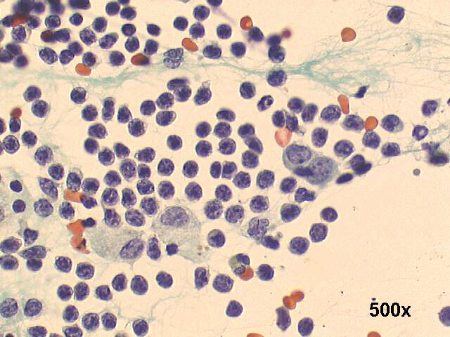 500x Papanicolaou staining