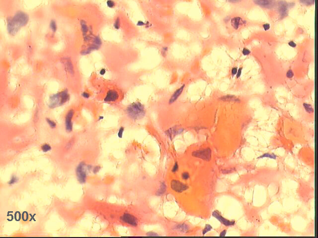 500x Pap staining