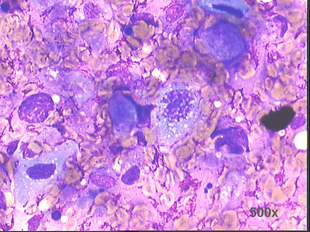 500x M-G-G staining