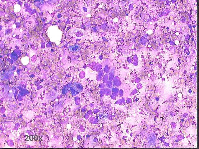 200x M-G-Gstaining