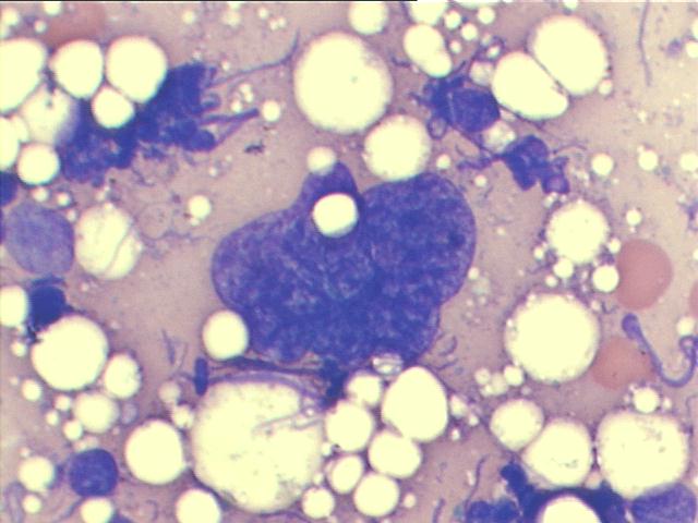 M-G-G staining, 1,000x, larger view of previous image