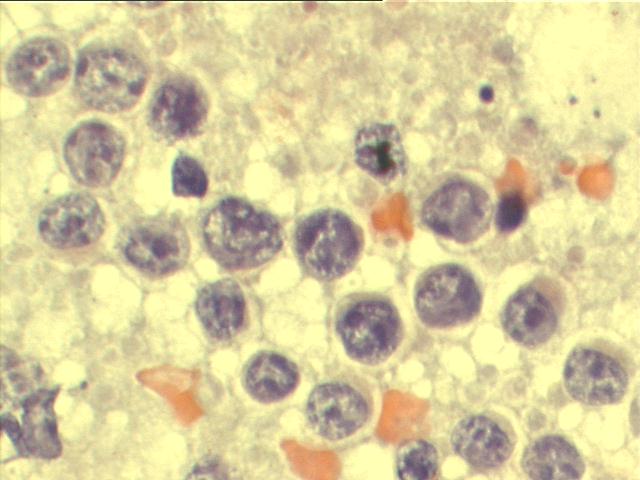 Papanicolaou staining, 1,000x