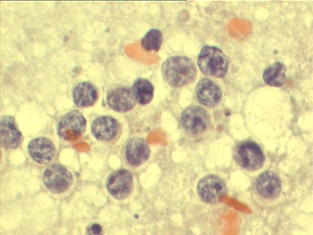 Papanicolaou staining, 1,000x
