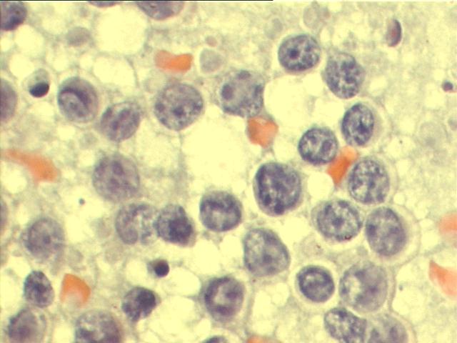 Papanicolaou staining, 1,000x