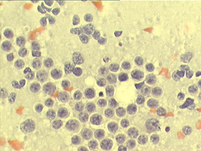 Papanicolaou staining, 500x