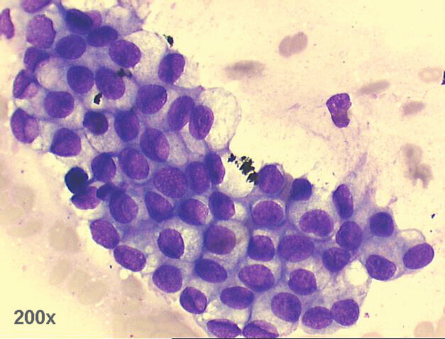 500x M-G-G staining - group of columnar and goblet cells, with benign morphology.