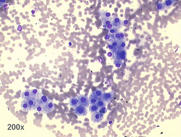200x M-G-G staining, groups of hepatocytes
