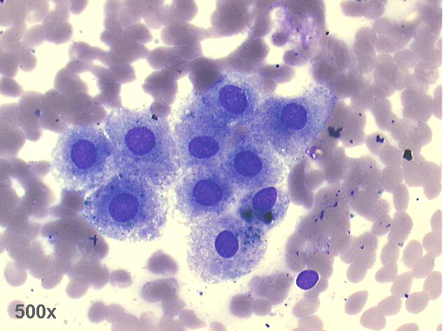 500x of previous image, M-G-G staining