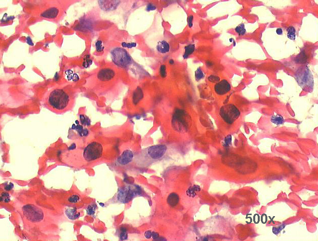 500x Pap staining