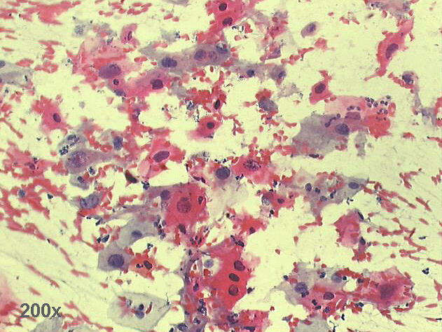 200x Pap staining