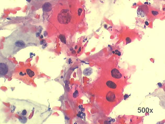 500x Pap staining