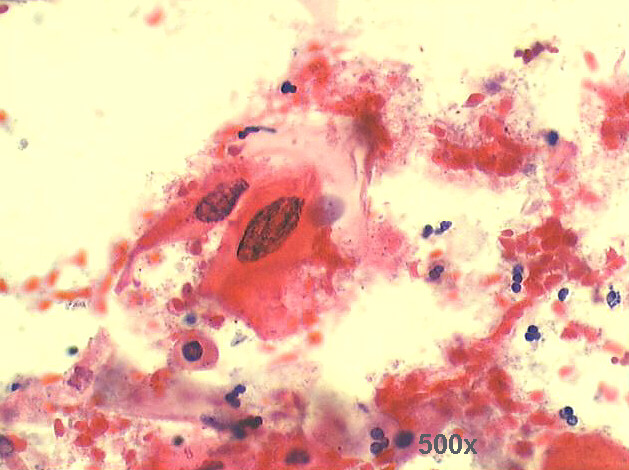 500x Pap staining