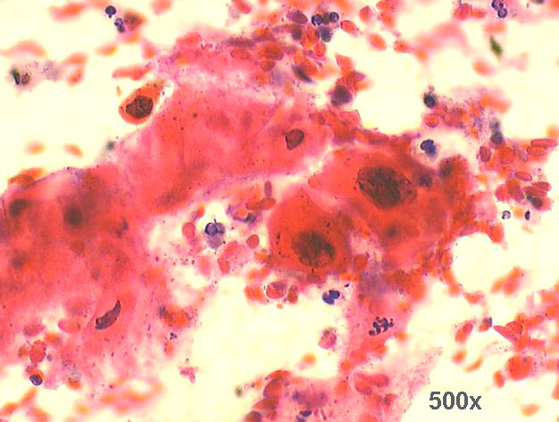 500x Pap staining