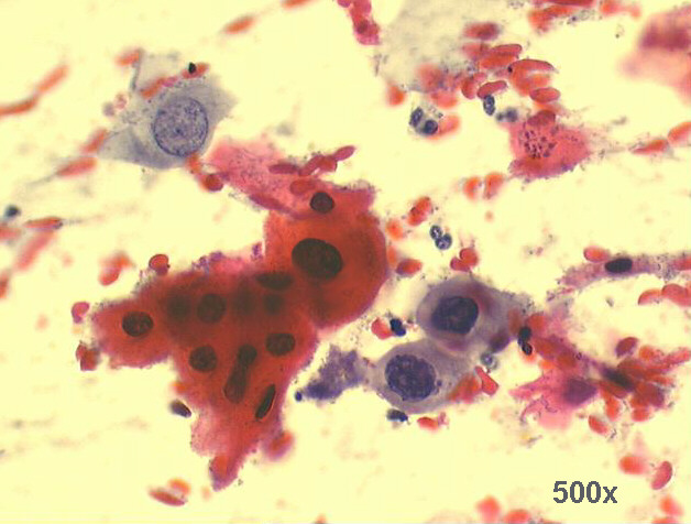 500x Pap staining