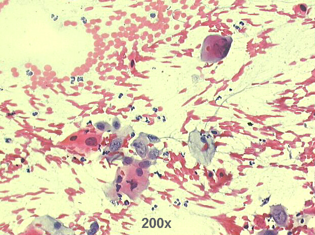200x Pap staining