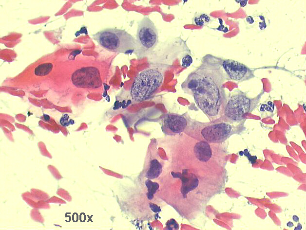 500x Pap staining
