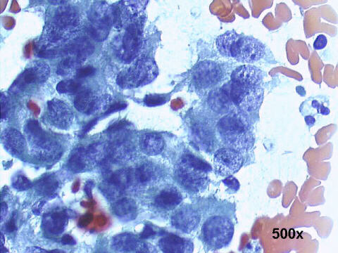 Papanicolaou staining