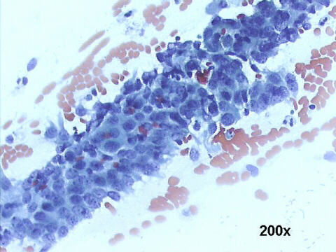 Papanicolaou staining