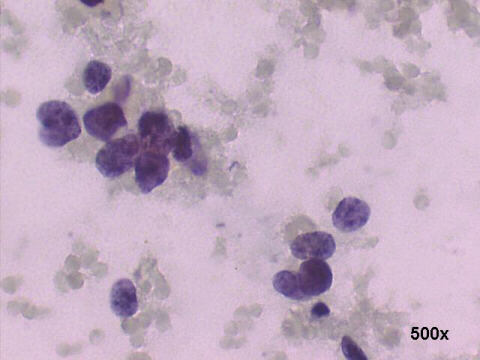 500x Papanicolaou staining
