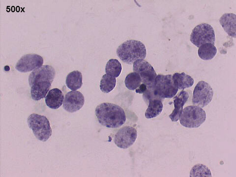 500x Papanicolaou staining, salt and pepper chromatin