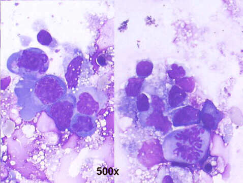 500x M-G-G staining