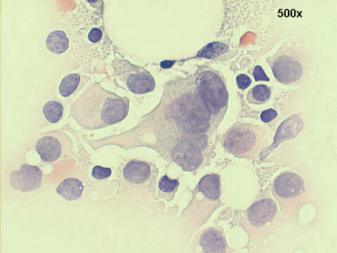500x Papanicolaou staining