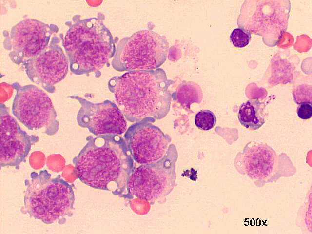 May-Gr�nwald-Giemsa staining