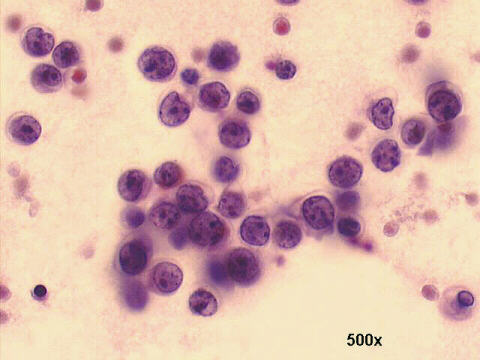 Papanicolaou staining