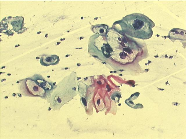 200x Pap staining