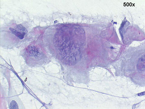 Papanicolaou staining