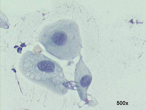 Papanicolaou staining
