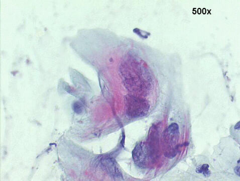 Papanicolaou staining
