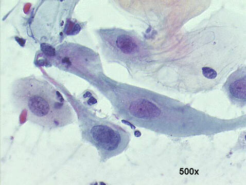 Papanicolaou staining