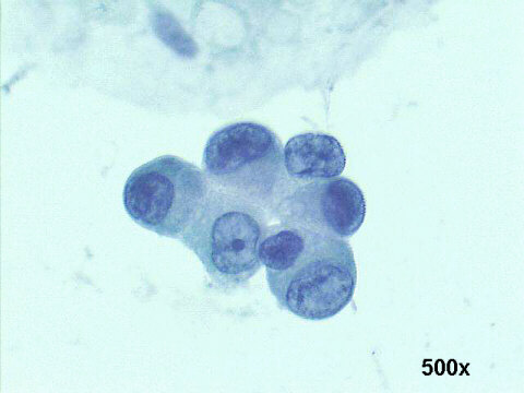 500x Papanicolaou staining