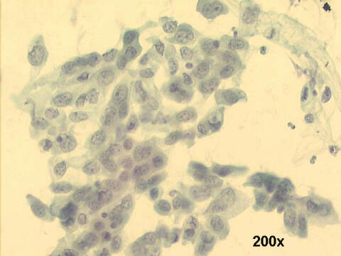 200x Papanicolaou staining