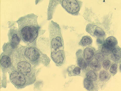 500x Papanicolaou staining