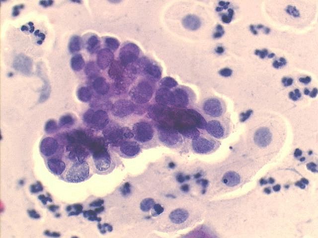 Papanicolaou staining